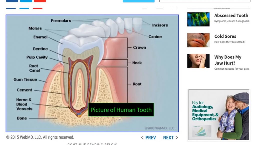 A website that uses "Picture of Human Tooth" incorrectly as alt attribute